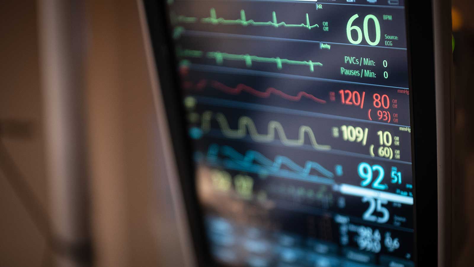 hospital monitor displaying cardiac information