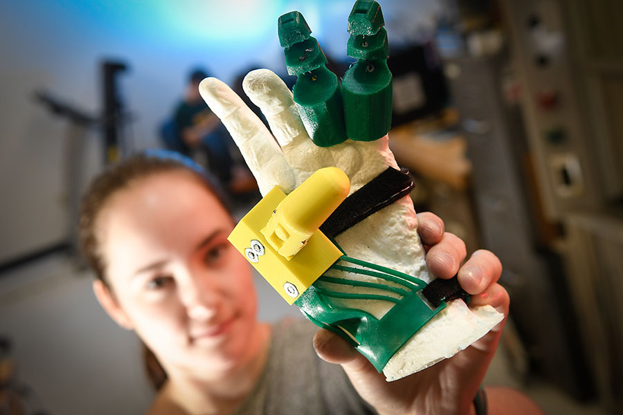 Student with a printed prosthetic